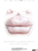 Caterpillarplasty在线观看和下载